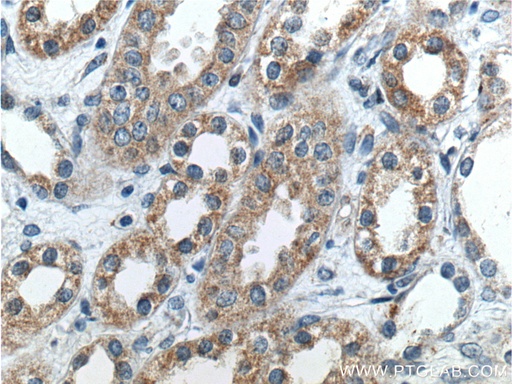 [14134-1-AP-20UL] Beta ENaC Polyclonal antibody