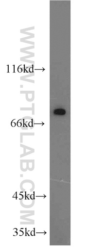 [14136-1-AP-150UL] KCNK5 Polyclonal antibody