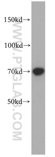 [14137-1-AP-150UL] RUFY2 Polyclonal antibody