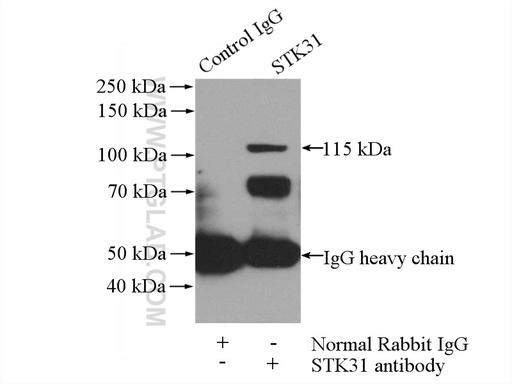 [14140-1-AP-150UL] STK31 Polyclonal antibody