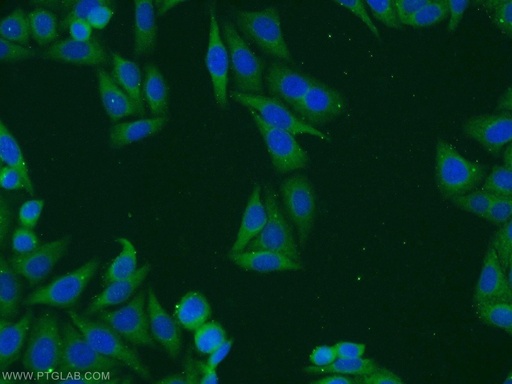 [14141-1-AP-150UL] TMED4 Polyclonal antibody