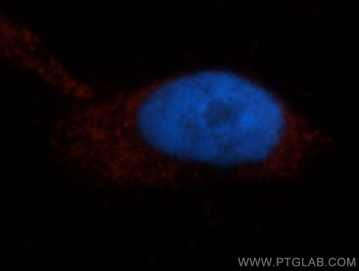 [14142-1-AP-20UL] ISYNA1 Polyclonal antibody