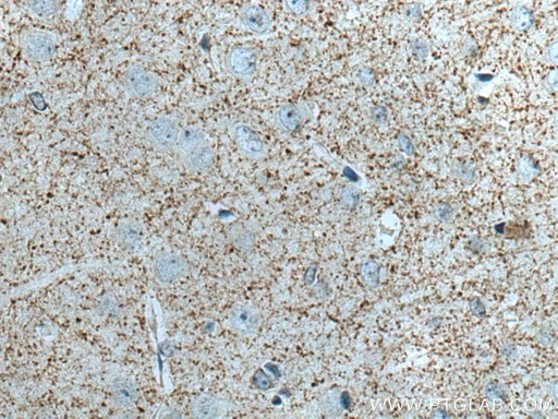 [14143-1-AP-150UL] Synaptoporin Polyclonal antibody