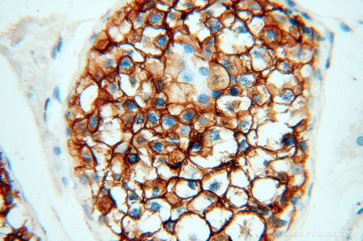 [14145-1-AP-150UL] VSIG1 Polyclonal antibody