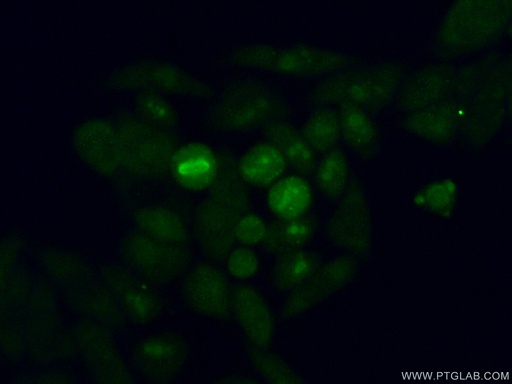 [14148-1-AP-20UL] ABT1 Polyclonal antibody