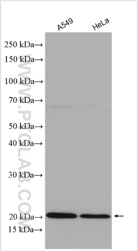 [14153-1-AP-20UL] IL-18BP Polyclonal antibody