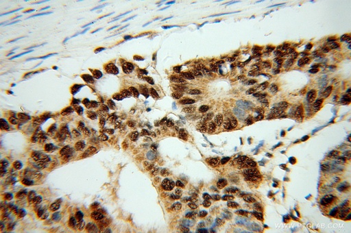 [14155-1-AP-20UL] FKBP5 Polyclonal antibody