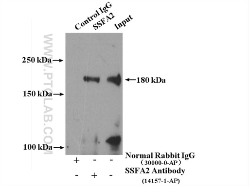 [14157-1-AP-150UL] KRAP/SSFA2 Polyclonal antibody