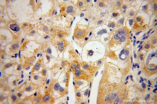 [14158-1-AP-150UL] MIPOL1 Polyclonal antibody