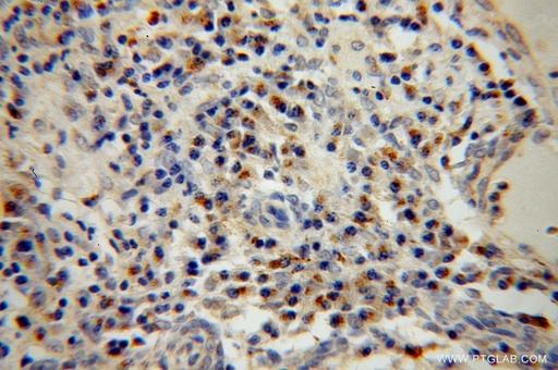 [14163-1-AP-150UL] BET1L Polyclonal antibody