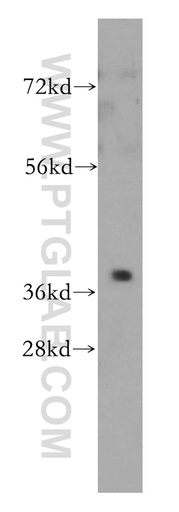 [14164-1-AP-150UL] PTGR2 Polyclonal antibody