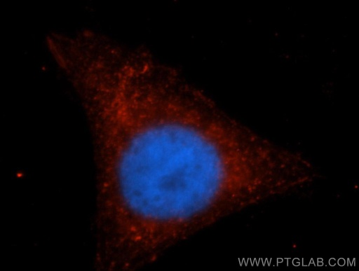[14167-1-AP-150UL] IRF9 Polyclonal antibody