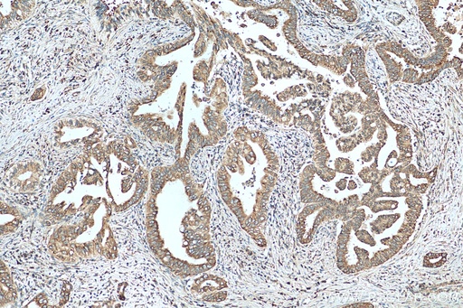 [14170-1-AP-150UL] UGCGL1 Polyclonal antibody