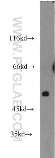 [14172-1-AP-20UL] SCTR Polyclonal antibody