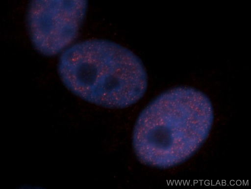 [14173-1-AP-20UL] CHD4 Polyclonal antibody
