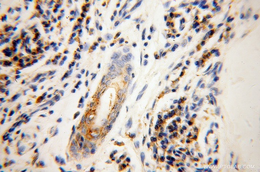 [14176-1-AP-20UL] GK3P Polyclonal antibody