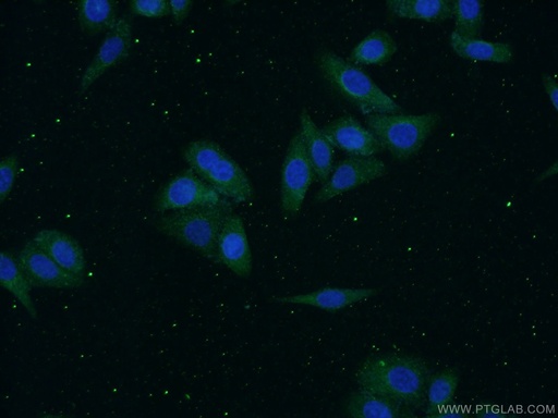 [14181-1-AP-150UL] Alpha 1B-Glycoprotein Polyclonal antibody