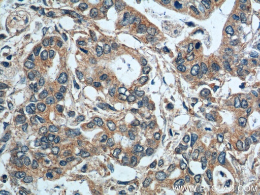 [14184-1-AP-150UL] SGSH Polyclonal antibody