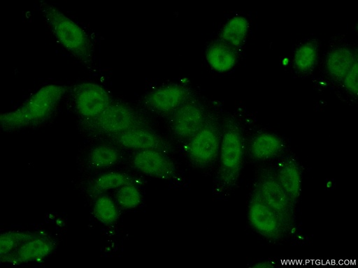 [14185-1-AP-20UL] SMC3 Polyclonal antibody
