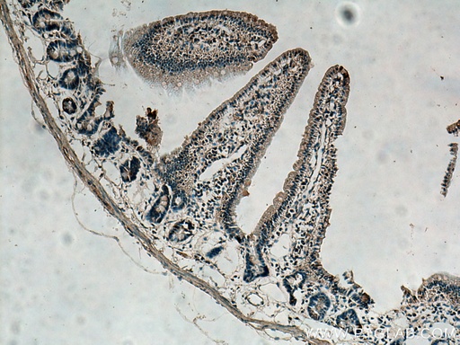 [14186-1-AP-150UL] UPP1 Polyclonal antibody