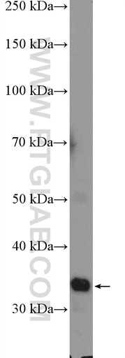[14190-1-AP-150UL] PPP1R3B Polyclonal antibody