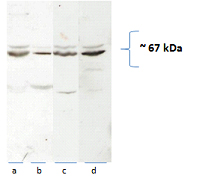 [14195-1-AP-150UL] CAT-1 Polyclonal antibody