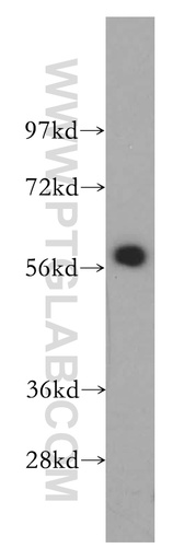 [14196-1-AP-150UL] CREB5 Polyclonal antibody