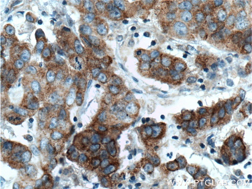 [14199-1-AP-150UL] TNK1 Polyclonal antibody