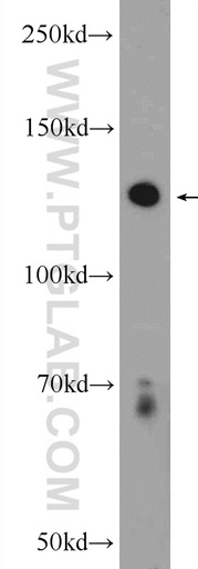 [14204-1-AP-20UL] PLEKHH2 Polyclonal antibody