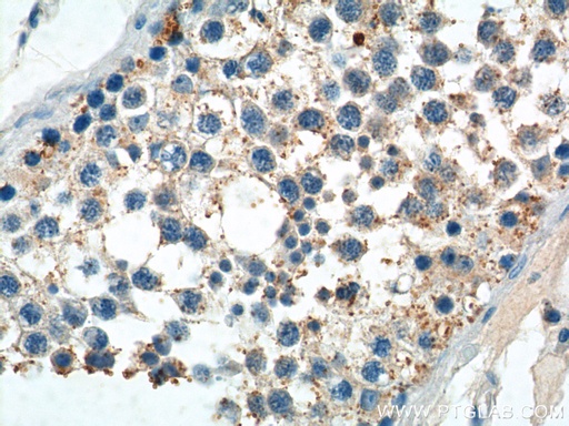 [14209-1-AP-20UL] PIWIL2 Polyclonal antibody