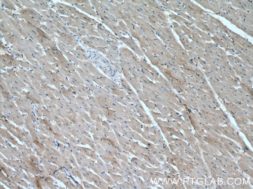 [14216-1-AP-20UL] CCL14 Polyclonal antibody