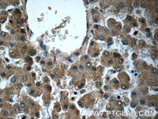[14219-1-AP-20UL] MTIF3 Polyclonal antibody