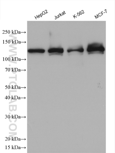 [14223-1-AP-150UL] RABGAP1 Polyclonal antibody