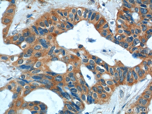 [14226-1-AP-150UL] S100A9 Polyclonal antibody