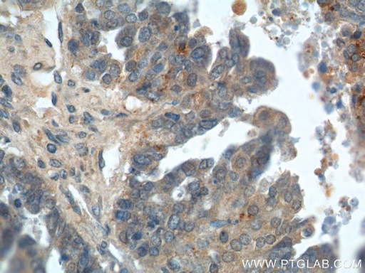 [14232-1-AP-20UL] Kallikrein 8 Polyclonal antibody