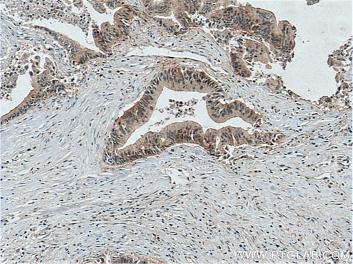 [14236-1-AP-150UL] LIV-1/ZIP6 Polyclonal antibody