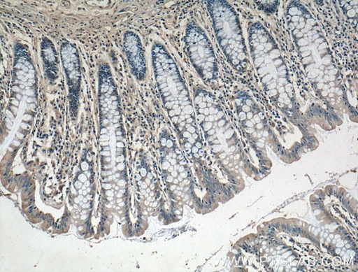[14237-1-AP-150UL] DUSP16 Polyclonal antibody