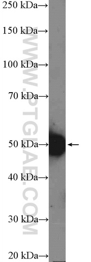 [14239-1-AP-150UL] RBMY1A1 Polyclonal antibody