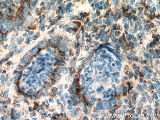 [14240-1-AP-150UL] SUCLG2 Polyclonal antibody