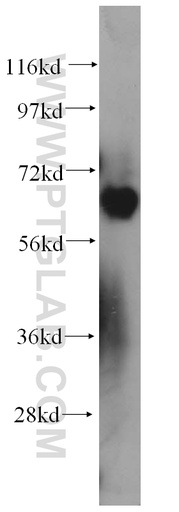 [14242-1-AP-150UL] PIAS4 Polyclonal antibody