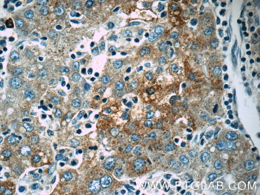 [14243-1-AP-20UL] Autotaxin Polyclonal antibody