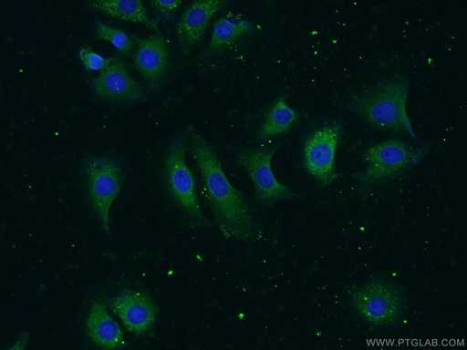 [14244-1-AP-150UL] MMP19 Polyclonal antibody