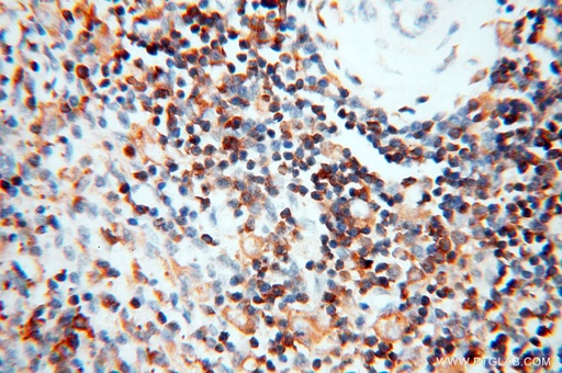 [14245-1-AP-20UL] BIN2 Polyclonal antibody