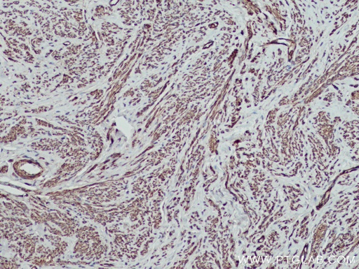 [14249-1-AP-150UL] MYL5 Polyclonal antibody