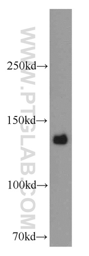 [14250-1-AP-150UL] CENPC Polyclonal antibody