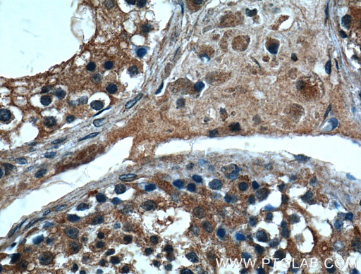 [14251-1-AP-150UL] MSRB3 Polyclonal antibody
