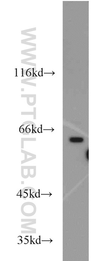 [14252-1-AP-20UL] APLF Polyclonal antibody