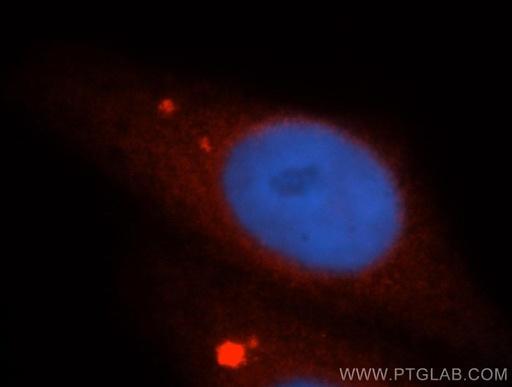[14253-1-AP-150UL] UBL4A Polyclonal antibody