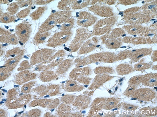 [14257-1-AP-20UL] MTP18 Polyclonal antibody
