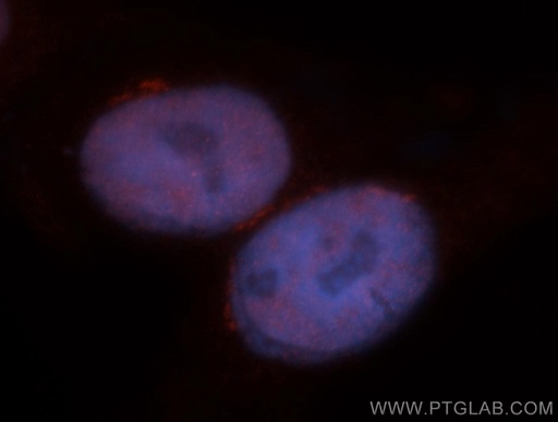 [14258-1-AP-20UL] MBD3 Polyclonal antibody